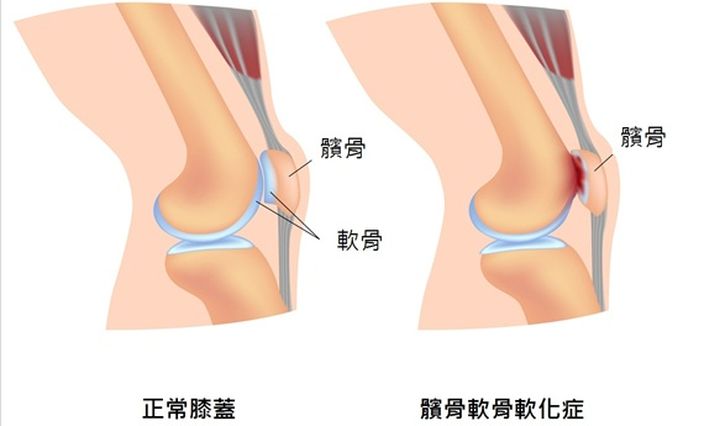網上圖片