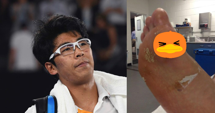 South Korea’s Hyeon Chung waves as he leaves Rod Laver Arena after retiring injured from his semifinal against Switzerland’s Roger Federer at the Australian Open tennis championships in Melbourne, Australia, Friday, Jan. 26, 2018. (AP Photo/Andy Brownbill)