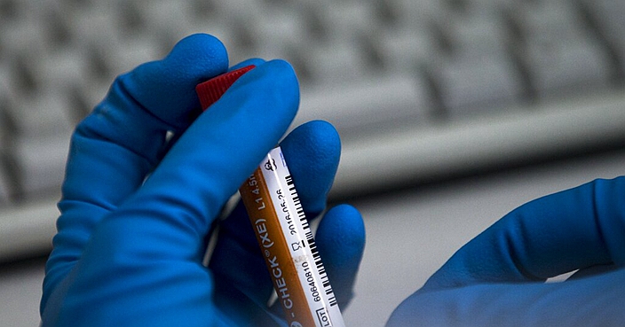 FILE - In this May 24, 2016 file photo an employee of the Russia's national drug-testing laboratory holds a vial in Moscow, Russia. Russia is accused of manipulating an archive of doping data from a laboratory in Moscow, which was meant to be a peace offering to the World Anti-Doping Agency to solve earlier disputes. (AP Photo/Alexander Zemlianichenko, File)